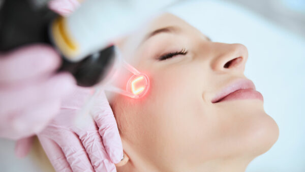 Fractional Laser (littekentherapie)