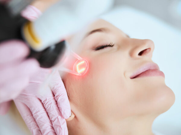 Fractional Laser (littekentherapie)